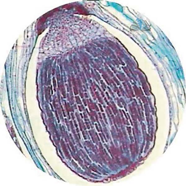 Prepared Microscope Slide - Club Moss (Mnium) Capsule L.S.