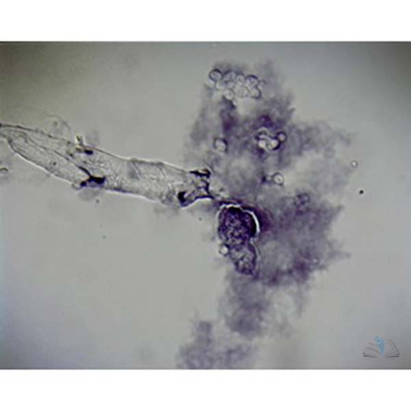 Prepared Microscope Slide - Amoeba proteus W.M.