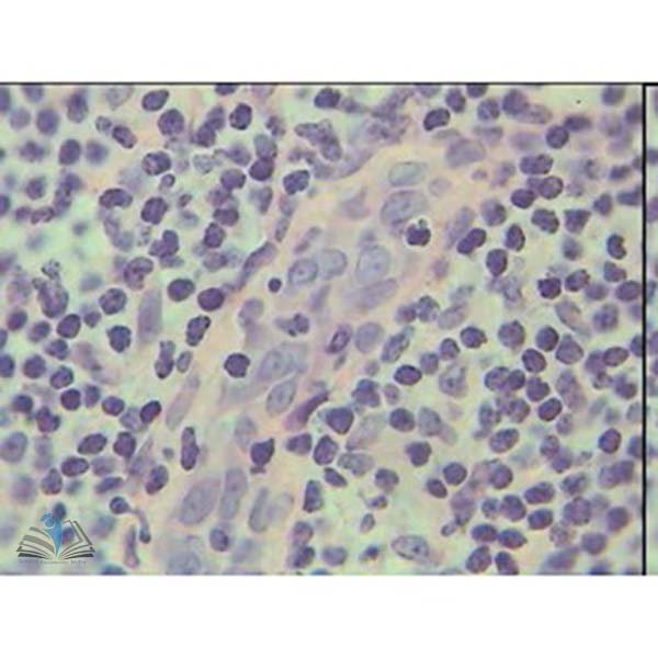 Prepared Microscope Slide - Lymph Node Cortex and Medulla T.S.