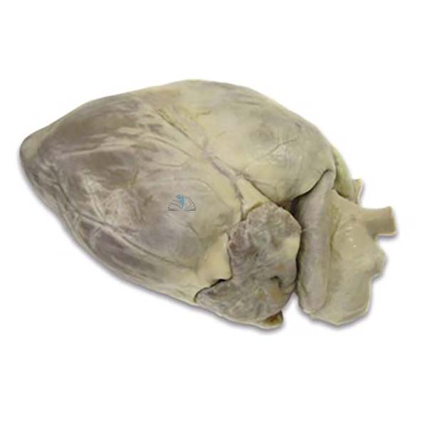 Heart (Preserved)