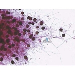 Prepared Microscope Slide - Bread Mould (Rhizopus stolonifer) with Zygospores W.M.